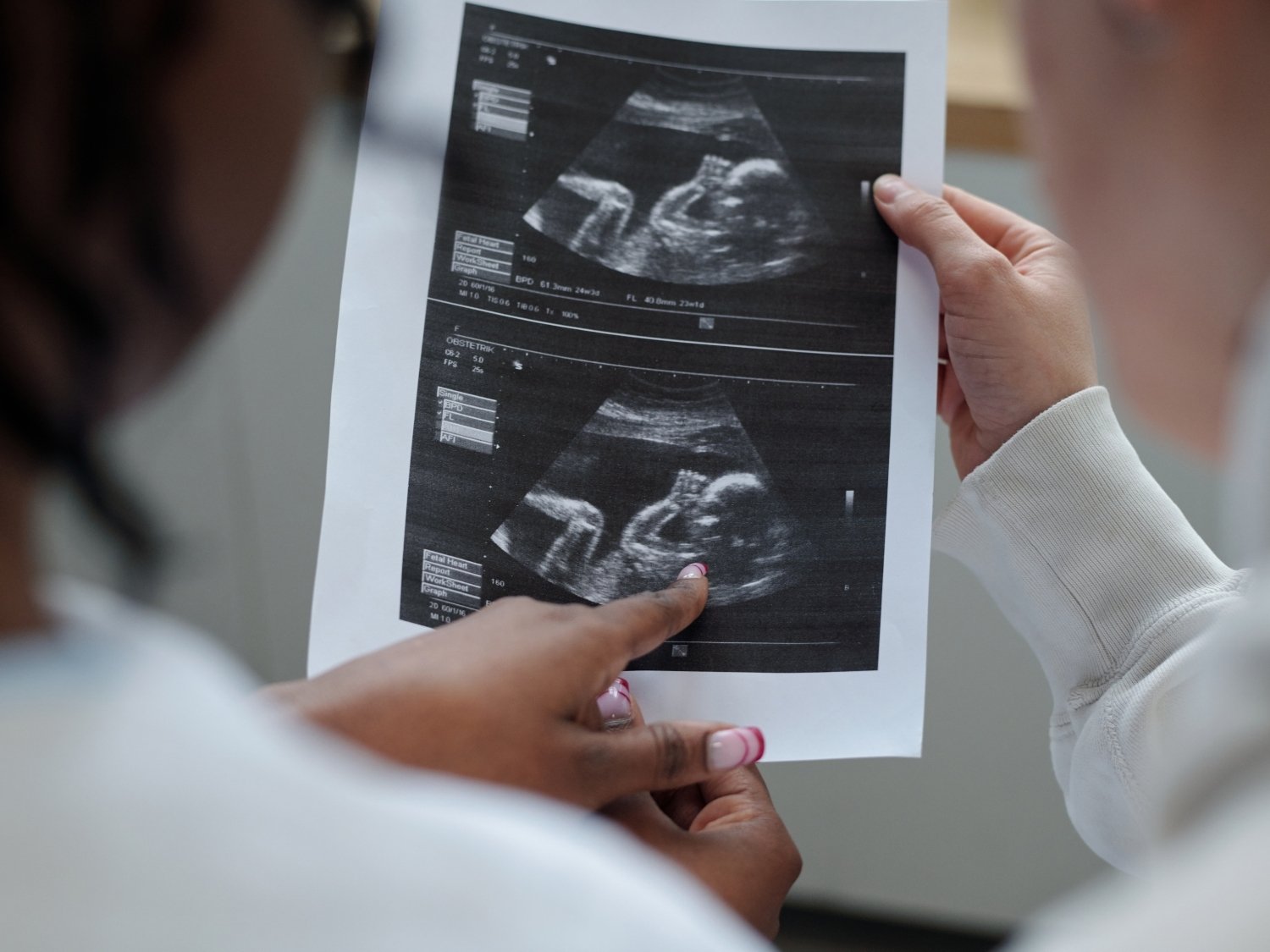 Fetal Growth Monitoring